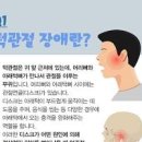 귀 아래 통증 턱관절 통증 원인 이미지