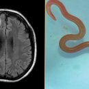 LARVA STAGE 이미지