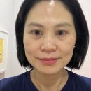 라라스킨 이미지