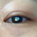 서울봄안과의원 이미지