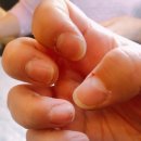 올 네일(All Nail) 이미지
