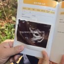 차경연산부인과의원 | 육아일기 : 임신 5주차 / 아기집 확인/심장소리/마미톡/산모수첩/임신확인서/왕십리산부인과 삼성제이...