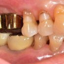 더드림치과기공소 이미지