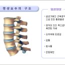 요추염좌 이미지