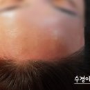 수경헤어라인 네이버블로그