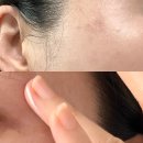 동아당약국 | 멜라논크림 vs 멜라토닝크림, 동아제약 제품 차이 효과 성분 뭐지
