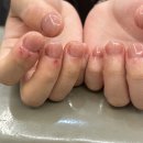 강남 물어뜯는 손톱 교정 네일 네일은청담 후기