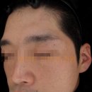 셀렉트피부과의원 네이버블로그