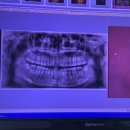 일산앞선치과의원 이미지