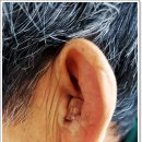 대구보청기 이미지