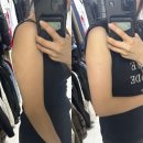 웰리스클리닉동물병원 | 유라인클리닉 지방분해주사 팔뚝컷주사 후기! 컷주사 원조 병원에서 받은 지방분해주사 솔직 리얼 후기