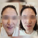 비야대정로 | 옥천 피부관리 만족하고 재방문한 조&amp;조헤드스파