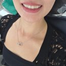 무삭제 라미네이트 세라네이트 한달차 솔직후기