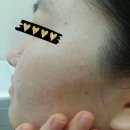 바르실래 이미지