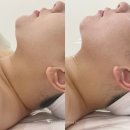 상봉공감모텔 | [상봉] 중랑구피부관리 맛집 <세렌느에스테틱>맞춤형 윤곽관리 후기 💆‍♀️