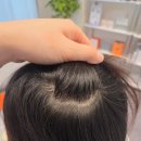 블룸뷰티 | 강남 헤드스파 그레이스블룸 뷰티 대만족 후기 여드름 관리와 두피 관리를 한번에
