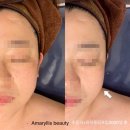 아마릴리스뷰티 네이버블로그
