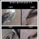 앙포레 이미지