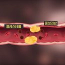 ◇ 심혈관질환 원인이 되는 중성지방 ◇ 이미지