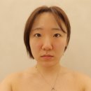 아이피부 | 대명동피부관리 물방울초음파 비치아이에스테틱 후기