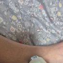 아셀케어 네이버블로그