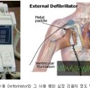 Defibrillator (심장제세동기) 이미지