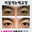 예쁜미인성형외과 이미지
