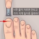 아델리오 네일&문제성손발톱 응암역촌점 네이버블로그