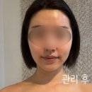 발산에서 받은 해독 리프팅, 브이라인 효과 발산역 [금쪽피부] 후기