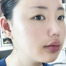 대한외과 | 강남실리프팅 신사역성형외과 내돈내산 후기 통증 효과