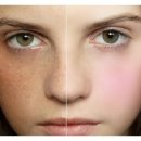 피브엔의원 이미지