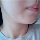 셀룰라이트제거 케이스키니 후기, 이걸 이제야 써보다니