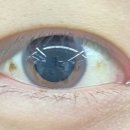 압구정에스앤비안과의원 이미지