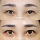 디비성형외과의원 이미지