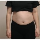 백일한의원 | 100일다이어트, -10kg 후기