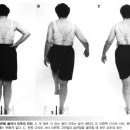 mis-10 요추의 운동손상 증후군(회전 신전 증후군) 이미지