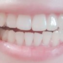 크리스탈치과기공소 이미지