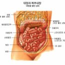 공명에 대해서 이미지