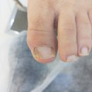 레푸스인천부평씨지브이(CGV)점 | 부평 무좀발톱 케어샵, 발관리 전문샵 레푸스부평CGV점