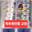 빈플러스