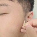 같지만 다른 얼굴 | 여수학동피부과에서 신랑 리팟레이저 흑자제거 후기 듀오덤 제거 후 3주차경과