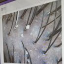 강남탈모 오기 전에 찾는 청담두피관리, 탑스칼프 논현점에서 받은 임신중 산전두피관리 후기