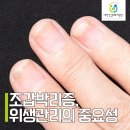 손톱발톱 이미지