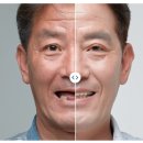 청담치과기공소 이미지