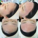 관저동 헤어라인왁싱 찐 잘하는곳 “아이러브”