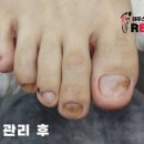 레푸스 사상점 이미지