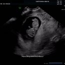 해피맘산부인과의원 이미지