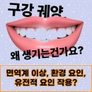 류마신백내과의원 | 부산 서구 류마신백내과에서 알려드리는 자가면역질환과 통풍의 특징