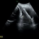 가재약국 | [18개월 아들, 30주 아들] 임산부 눈떨림 마그네슘 처방, 철분 부족할 땐 고기앞으로