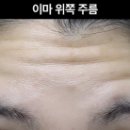 필리프트성형외과의원 이미지